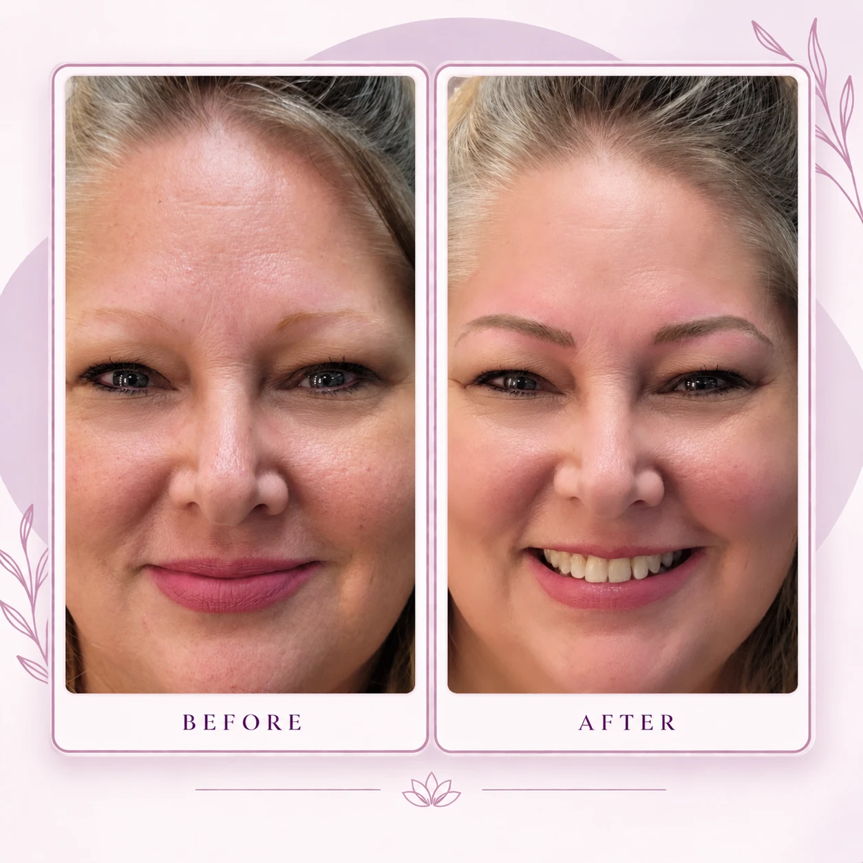 Before and after an immediate post-procedure permanent makeup result on mature skin